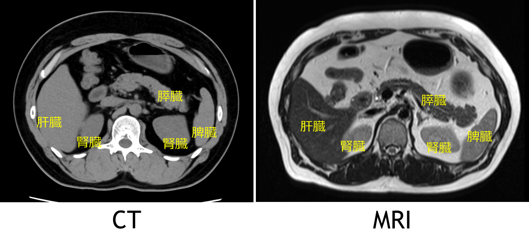  MEP テストとその用途とは何ですか?